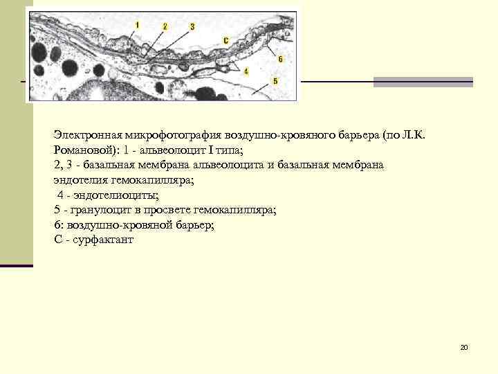 Электронная микрофотография воздушно-кровяного барьера (по Л. К. Романовой): 1 - альвеолоцит I типа; 2,