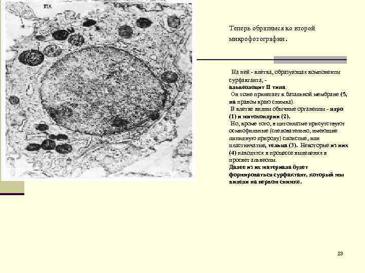 Теперь обратимся ко второй микрофотографии. На ней - клетка, образующая компоненты сурфактанта, - альвеолоцит