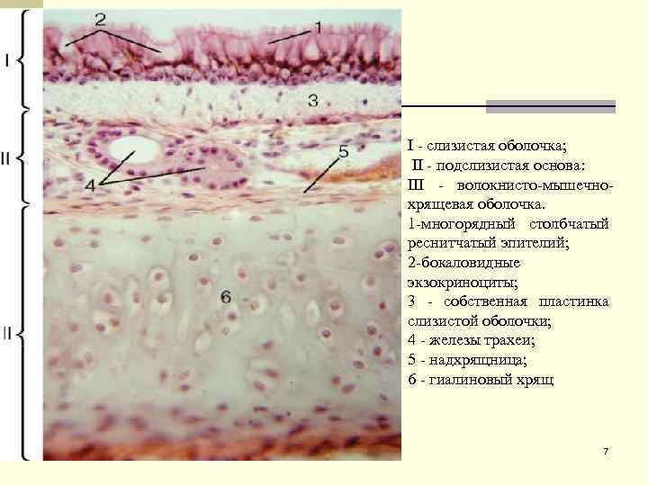 I - слизистая оболочка; II - подслизистая основа: III - волокнисто-мышечнохрящевая оболочка. 1 -многорядный