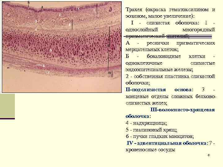 Трахея (окраска гематоксилином и эозином, малое увеличение): I - слизистая оболочка: 1 - однослойный