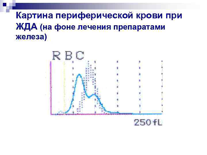Картина периферической крови при ЖДА (на фоне лечения препаратами железа) 