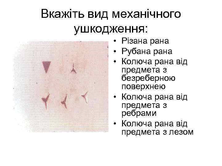 Вкажіть вид механічного ушкодження: • Різана рана • Рубана рана • Колюча рана від