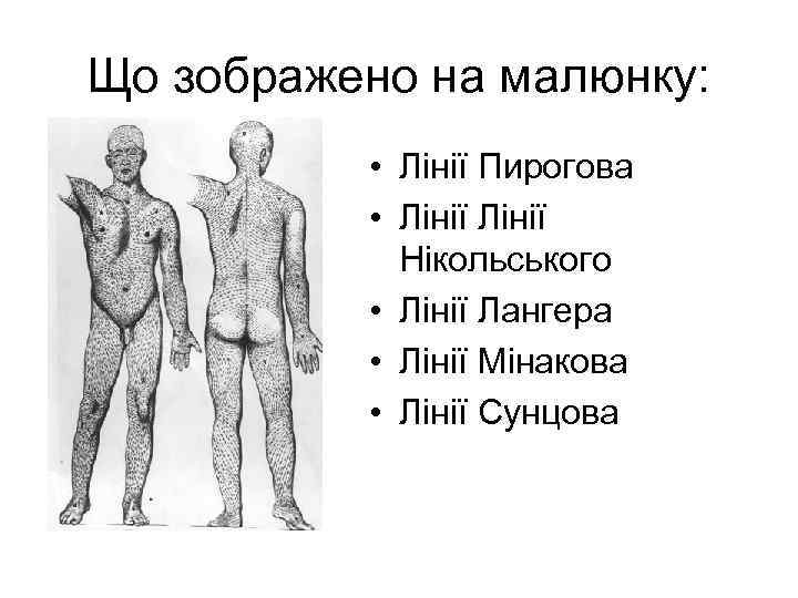 Що зображено на малюнку: • Лінії Пирогова • Лінії Нікольського • Лінії Лангера •