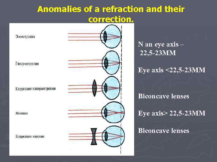 Anomalies of a refraction and their correction. N an eye axis – 22, 5