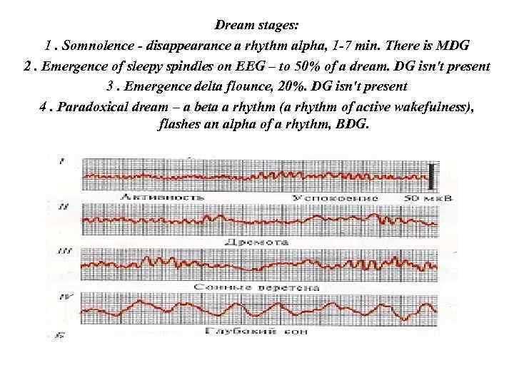 Dream stages: 1. Somnolence - disappearance a rhythm alpha, 1 -7 min. There is