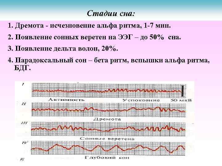 Стадии сна: 1. Дремота - исчезновение альфа ритма, 1 -7 мин. 2. Появление сонных