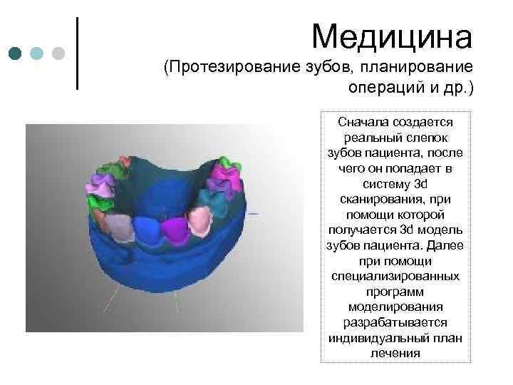 Медицина (Протезирование зубов, планирование операций и др. ) Сначала создается реальный слепок зубов пациента,
