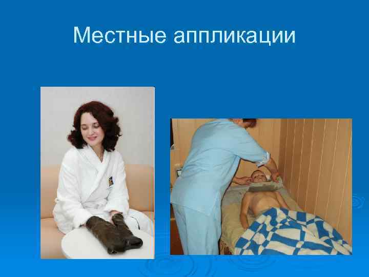 Местные аппликации 