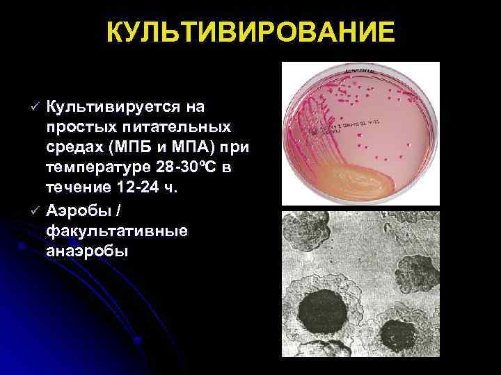КУЛЬТИВИРОВАНИЕ ü ü Культивируется на простых питательных средах (МПБ и МПА) при температуре 28
