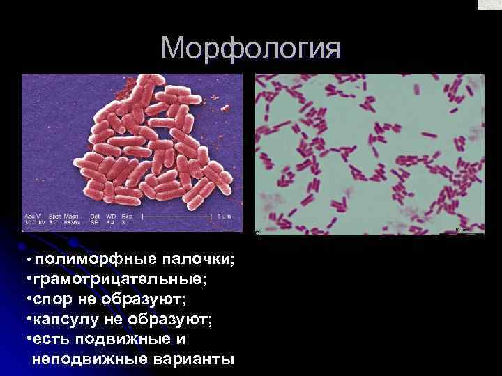 Морфология • полиморфные палочки; • грамотрицательные; • спор не образуют; • капсулу не образуют;