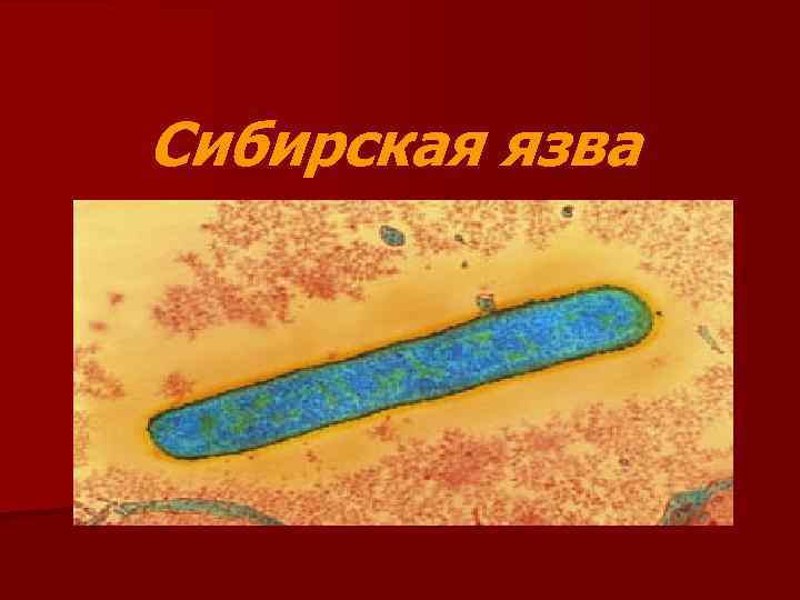 Сибирская язва 