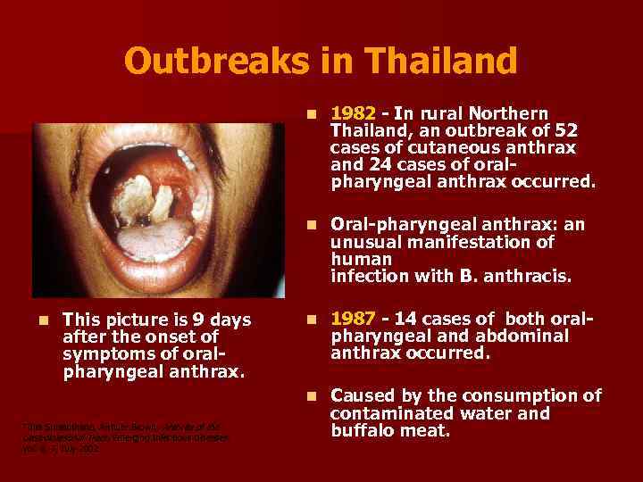 Outbreaks in Thailand n n This picture is 9 days after the onset of