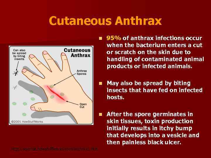 Cutaneous Anthrax n n May also be spread by biting insects that have fed