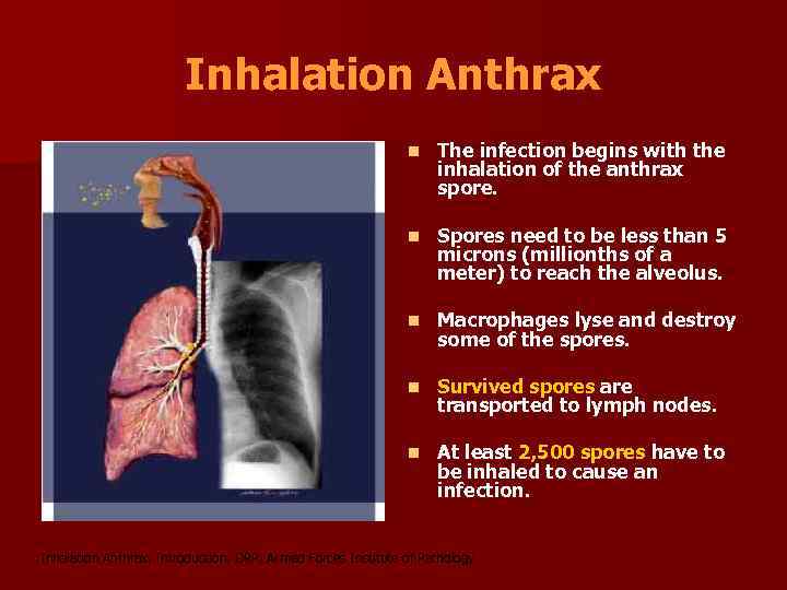 Inhalation Anthrax n The infection begins with the inhalation of the anthrax spore. n