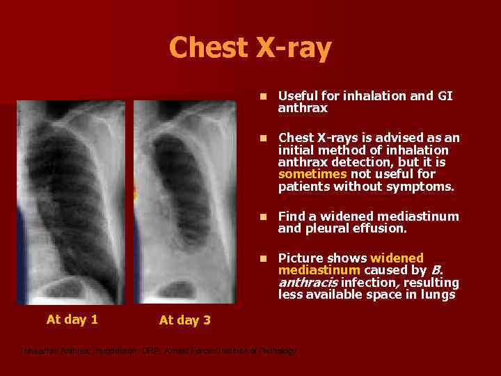 Chest X-ray n n Chest X-rays is advised as an initial method of inhalation