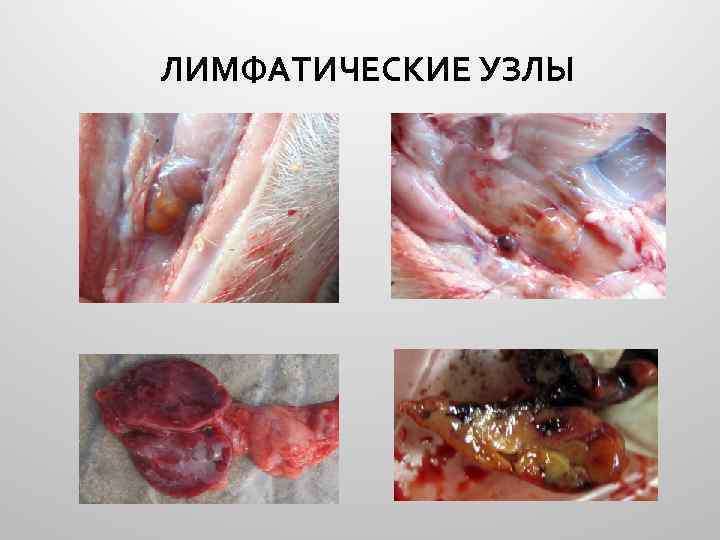 ЛИМФАТИЧЕСКИЕ УЗЛЫ 