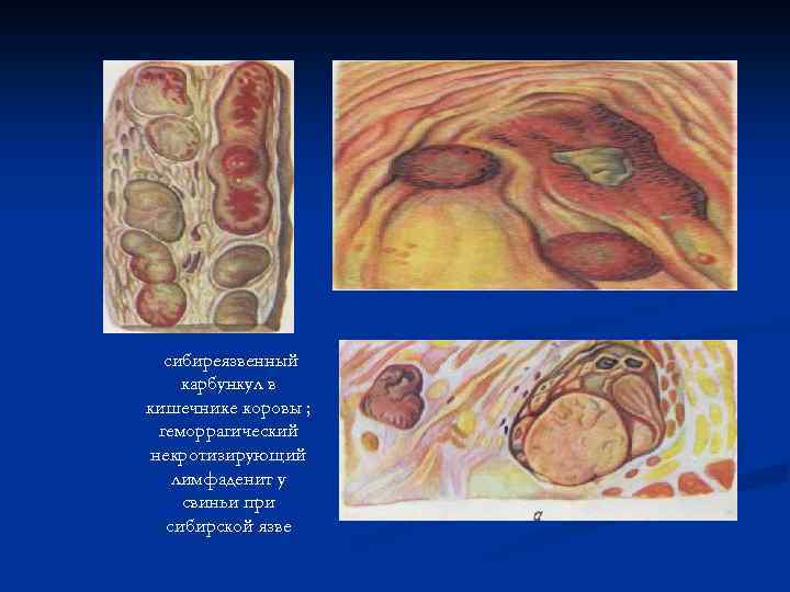 сибиреязвенный карбункул в кишечнике коровы ; геморрагический некротизирующий лимфаденит у свиньи при сибирской язве