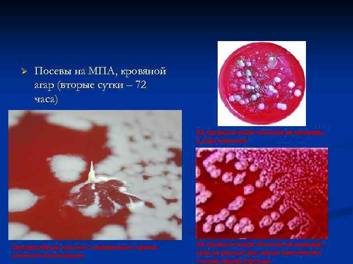 Ø Посевы на МПА, кровяной агар (вторые сутки – 72 часа) На кровяном агаре