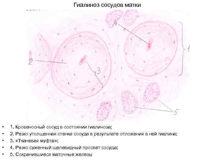 Сосуды матки