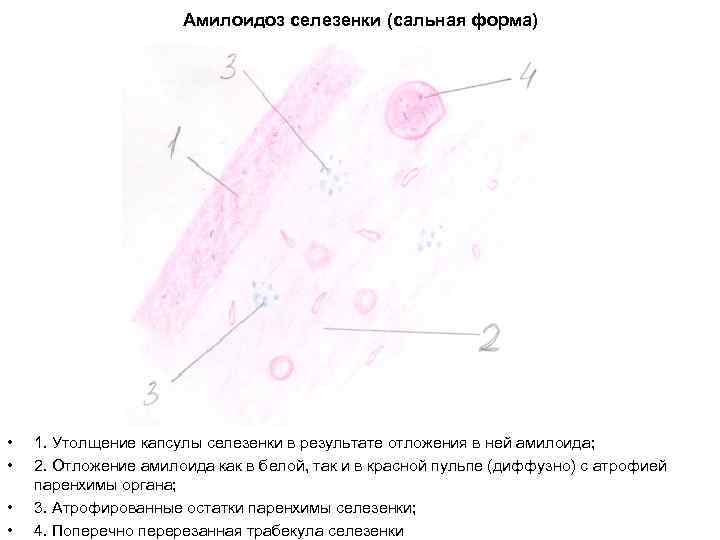 Саговая селезенка микропрепарат рисунок