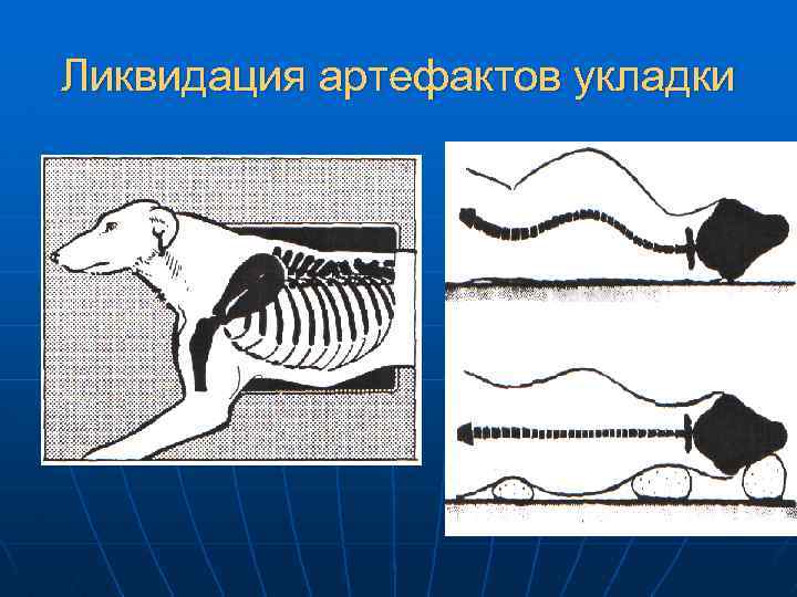 Ликвидация артефактов укладки 