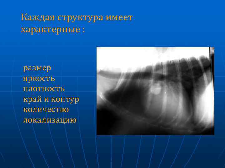 Каждая структура имеет характерные : размер яркость плотность край и контур количество локализацию 