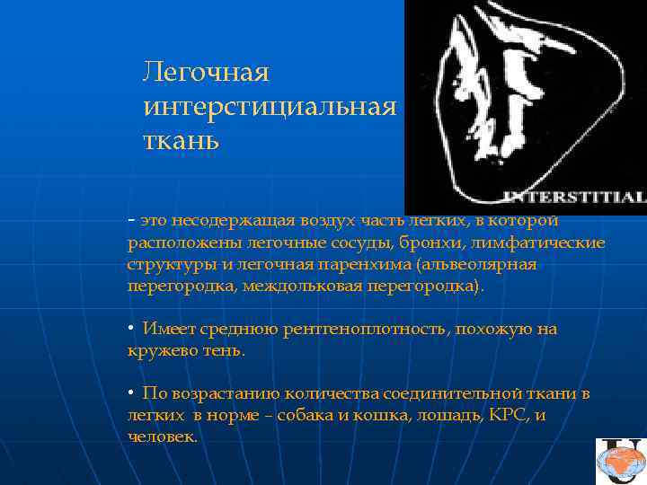 Легочная интерстициальная ткань - это несодержащая воздух часть легких, в которой расположены легочные сосуды,