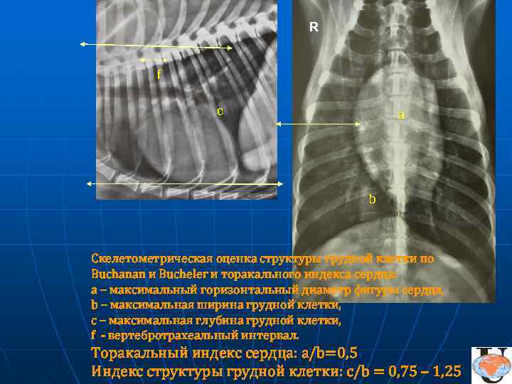 R f c а b Скелетометрическая оценка структуры грудной клетки по Buchanan и Bucheler