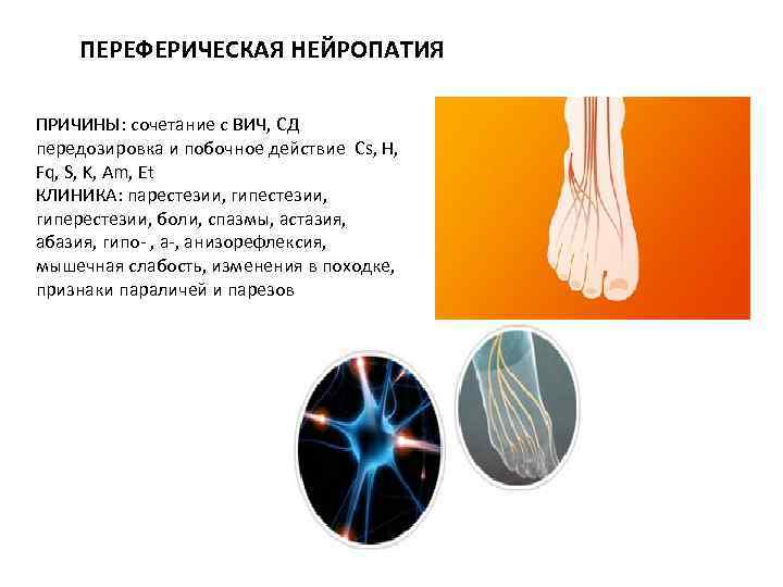 ПЕРЕФЕРИЧЕСКАЯ НЕЙРОПАТИЯ ПРИЧИНЫ: сочетание с ВИЧ, СД передозировка и побочное действие Cs, H, Fq,