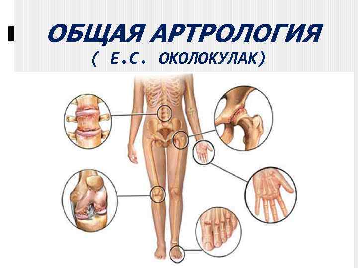 ОБЩАЯ АРТРОЛОГИЯ ( Е. С. ОКОЛОКУЛАК) 