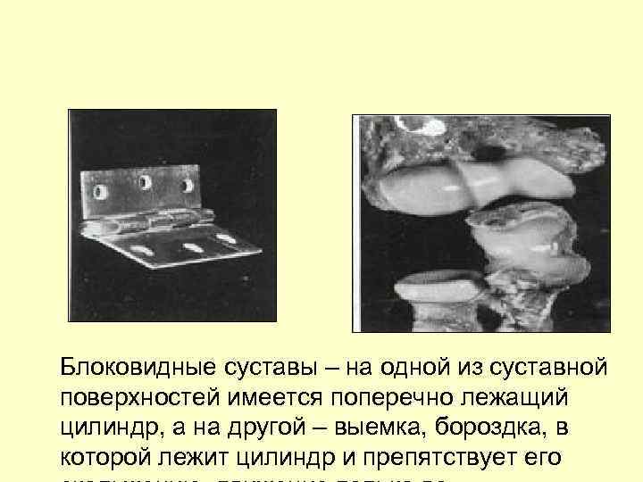 Блоковидные суставы – на одной из суставной поверхностей имеется поперечно лежащий цилиндр, а на