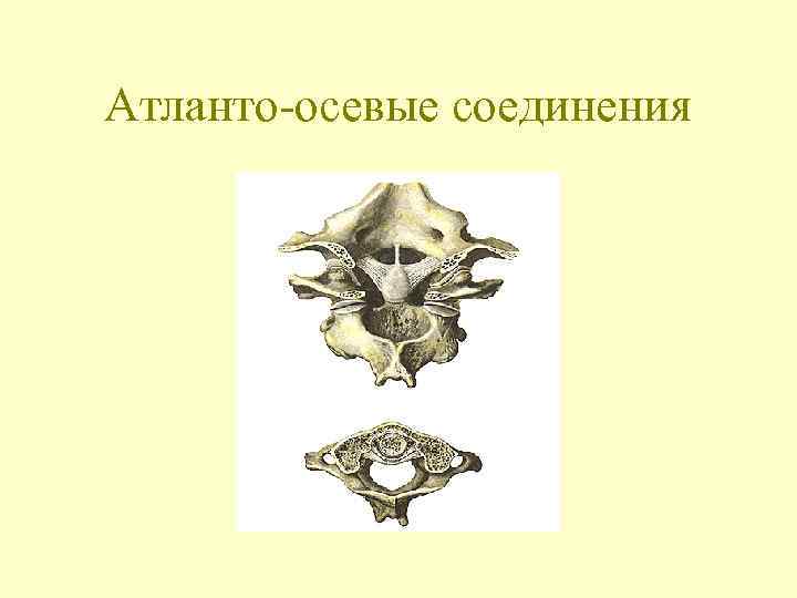 Атланто-осевые соединения 