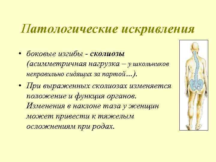 Патологические искривления • боковые изгибы - сколиозы (асимметричная нагрузка – у школьников неправильно сидящих