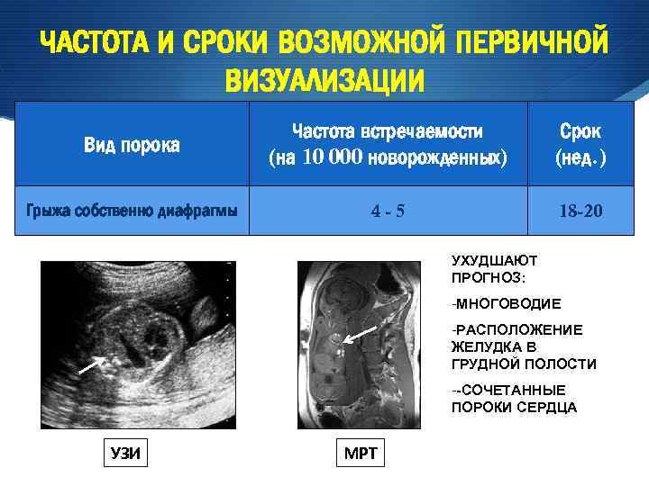Пренатальное развитие. Частота встречаемости пороков сердца. Врожденные пороки развития ЖКТ таблица. Пороки развития желудка диагностика. Грыжи живота частота встречаемости.