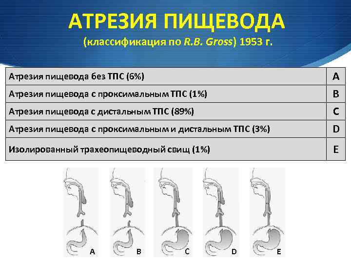 Атрезия пищевода у детей презентация