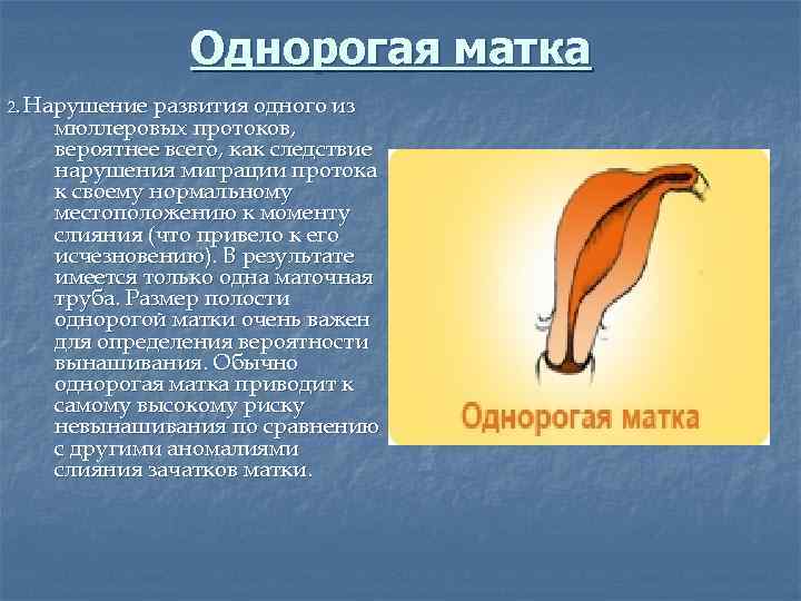 Однорогая матка 2. Нарушение развития одного из мюллеровых протоков, вероятнее всего, как следствие нарушения