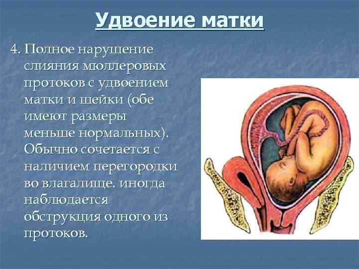 Удвоение матки 4. Полное нарушение слияния мюллеровых протоков с удвоением матки и шейки (обе