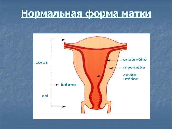 Нормальная форма матки 