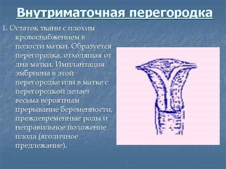 Внутриматочная перегородка 1. Остаток ткани с плохим кровоснабжением в полости матки. Образуется перегородка, отходящая