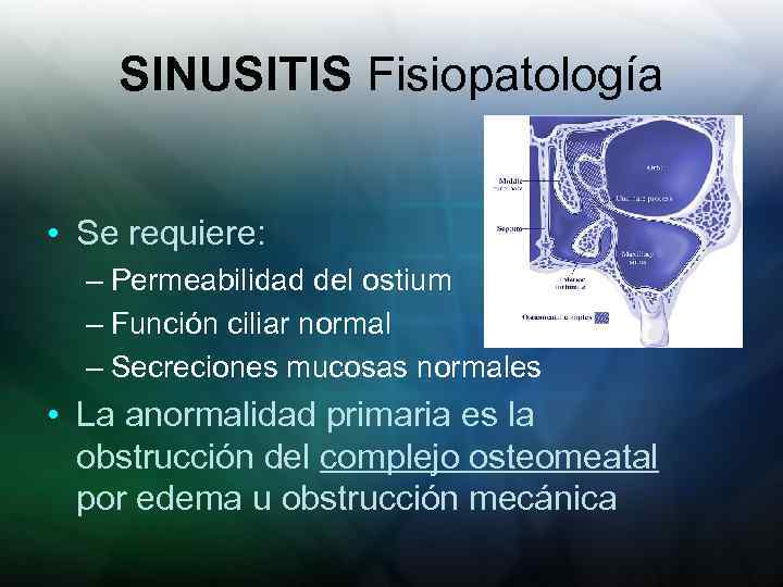 SINUSITIS Fisiopatología • Se requiere: – Permeabilidad del ostium – Función ciliar normal –