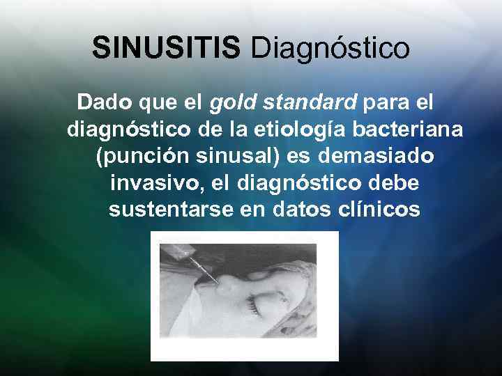 SINUSITIS Diagnóstico Dado que el gold standard para el diagnóstico de la etiología bacteriana