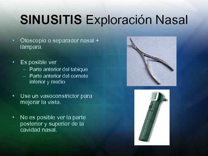 SINUSITIS Exploración Nasal • Otoscopio o separador nasal + lámpara. • Es posible ver