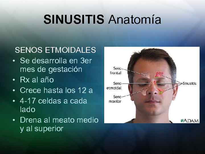 SINUSITIS Anatomía SENOS ETMOIDALES • Se desarrolla en 3 er mes de gestación •