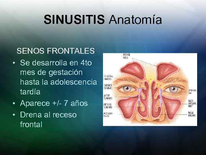 SINUSITIS Anatomía SENOS FRONTALES • Se desarrolla en 4 to mes de gestación hasta