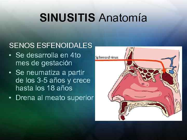 SINUSITIS Anatomía SENOS ESFENOIDALES • Se desarrolla en 4 to mes de gestación •