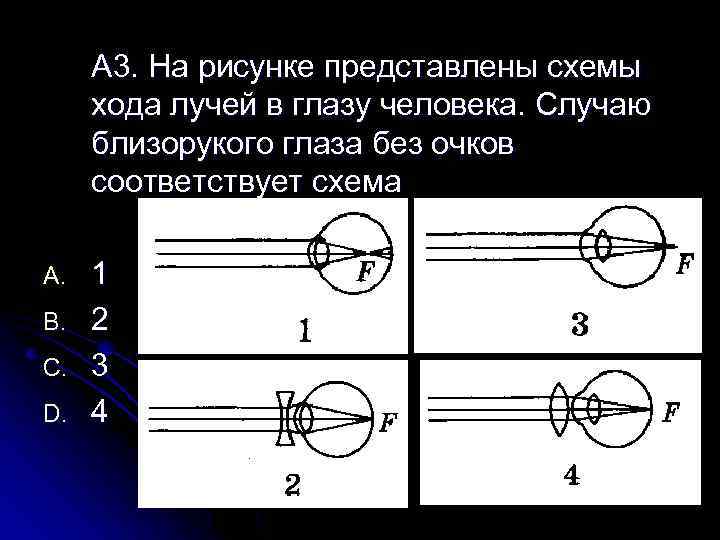 Схема близорукости глаза с очками