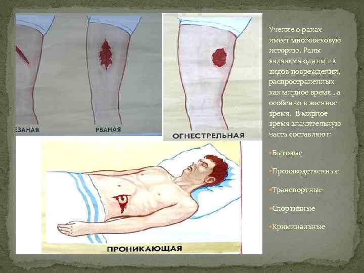 Учение о ранах имеет многовековую историю. Раны являются одним из видов повреждений, распространенных как