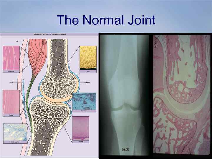 The Normal Joint 
