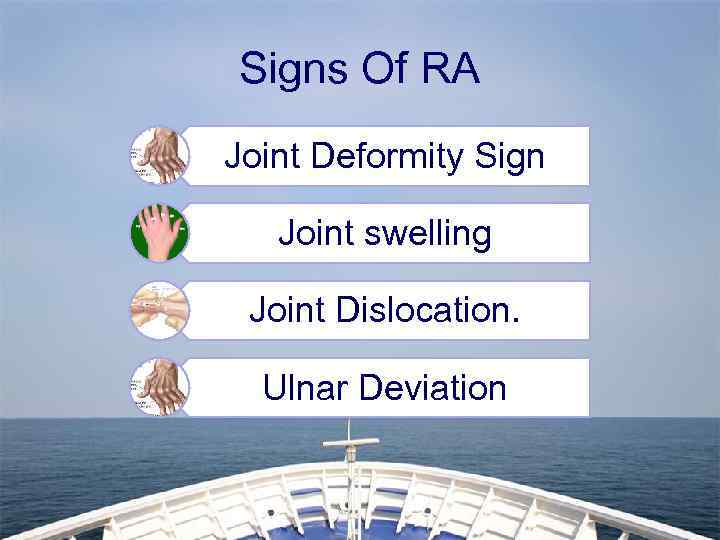 Signs Of RA Joint Deformity Sign Joint swelling Joint Dislocation. Ulnar Deviation 