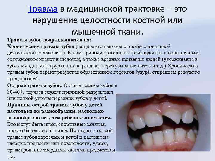 Травма в медицинской трактовке – это нарушение целостности костной или мышечной ткани. Травмы зубов